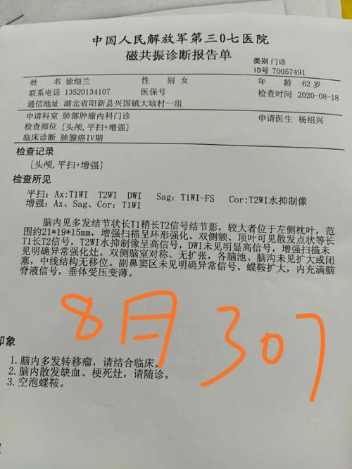 干咳两个月查出肺癌,上门取货_123随叫随到